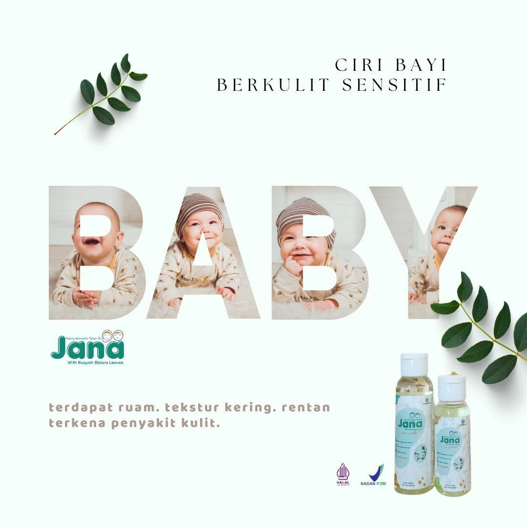 Ciri Bayi Berkulit Sensitif